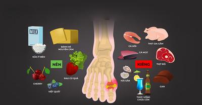 Bệnh gút (gout ) là gì? Nguyên nhân, triệu chứng và cách phòng tránh