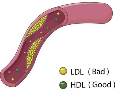 Chỉ Số LDL Cholesterol Trong Máu Và Những Điều Cần Biết Về Nó