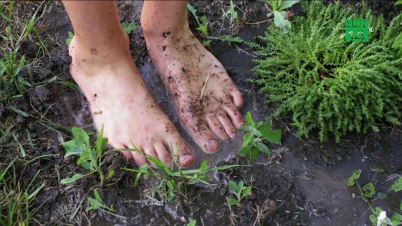 Bệnh Whitmore Là Gì? Nguyên Nhân Gây Bệnh Whitmore