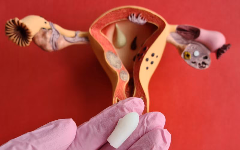 Công Dụng Thuốc Đặt Phụ Khoa Và Những Lưu Ý Khi Sử Dụng